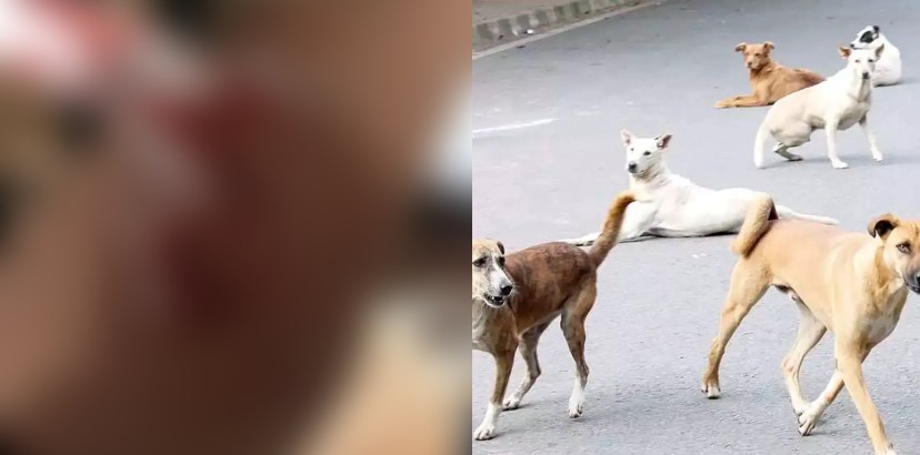 കോഴിക്കോട് വീണ്ടും തെരുവുനായ ആക്രമണം; രണ്ട് കുട്ടികളുള്‍പ്പെടെ നാല് പേര്‍ക്ക് പരുക്ക്