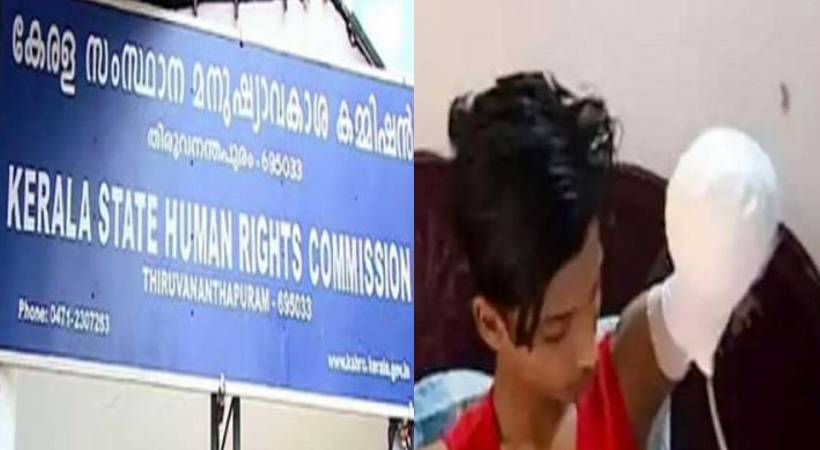 വിദ്യാർത്ഥിയുടെ കൈ കൈമുറിച്ചു മാറ്റിയ സംഭവത്തിൽ മനുഷ്യാവകാശ കമ്മിഷൻ അന്വേഷണത്തിന് ഉത്തരവിട്ടു.