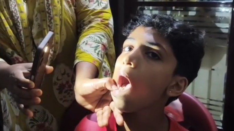 11കാരന്റെ കേടായ പല്ലിന് പകരം എടുത്തത് മറ്റൊരു പല്ല്; നാദാപുരം ഗവ. താലൂക്ക് ആശുപത്രിയ്‌ക്കെതിരെ ചികിത്സ പിഴവ് ആരോപണം; രണ്ടും എടുക്കേണ്ട പല്ലുകളായിരുന്നെന്ന് ഡോക്ടര്‍